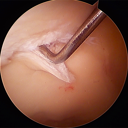 Condition Cartilage